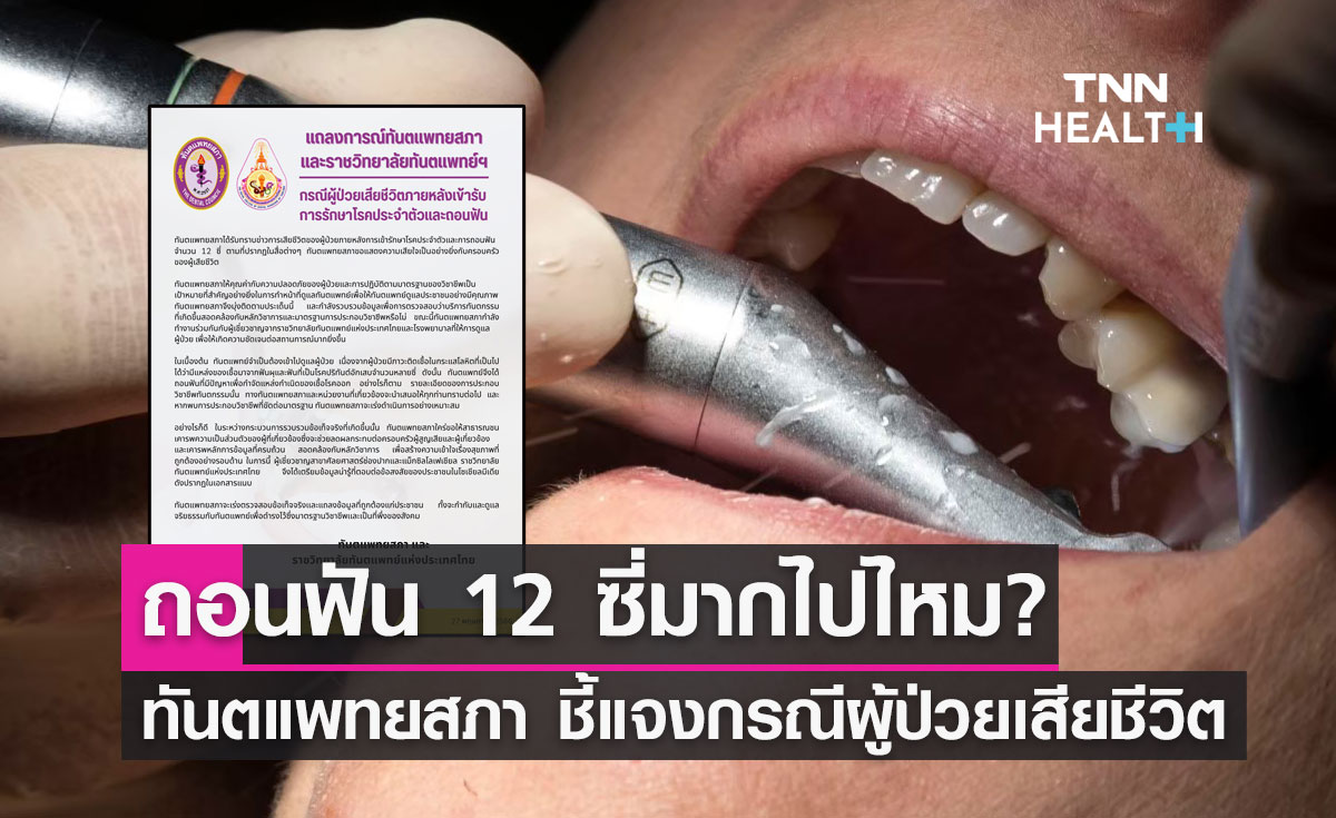 ถอนฟัน 12 ซี่มากไปไหม? ทันตแพทยสภา แถลงการณ์กรณีผู้ป่วยเสียชีวิต