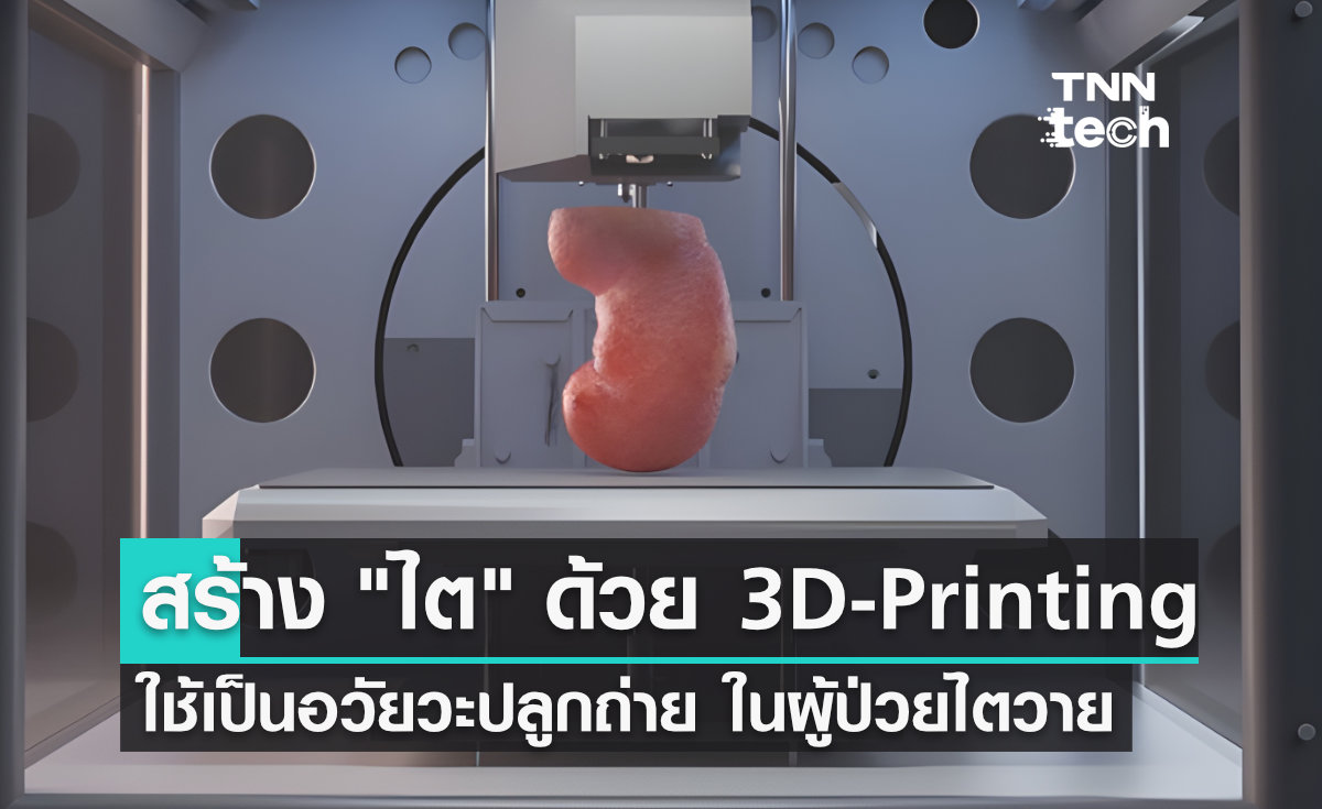 สร้าง ไต ด้วย 3D-printing เพื่อเป็นอวัยวะปลูกถ่ายแก่ผู้ป่วยไตวายเรื้อรัง