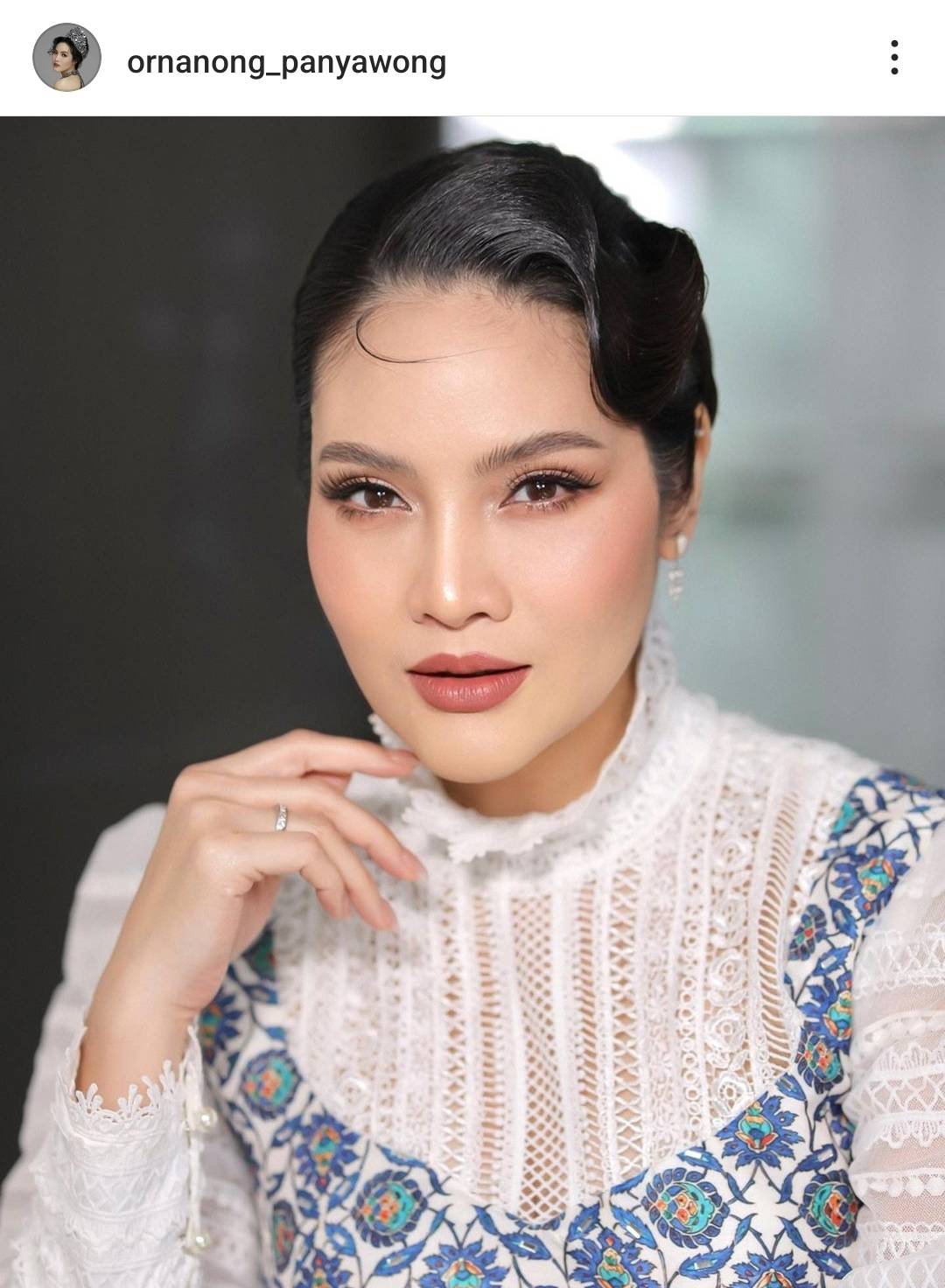 อรอนงค์ ตรวจพบต่อมไทมัสโต เตรียมผ่าตัด ตุลาคมนี้ อรอนงค์ ตรวจพบต่อมไทมัสโต เตรียมผ่าตัด ตุลาคมนี้