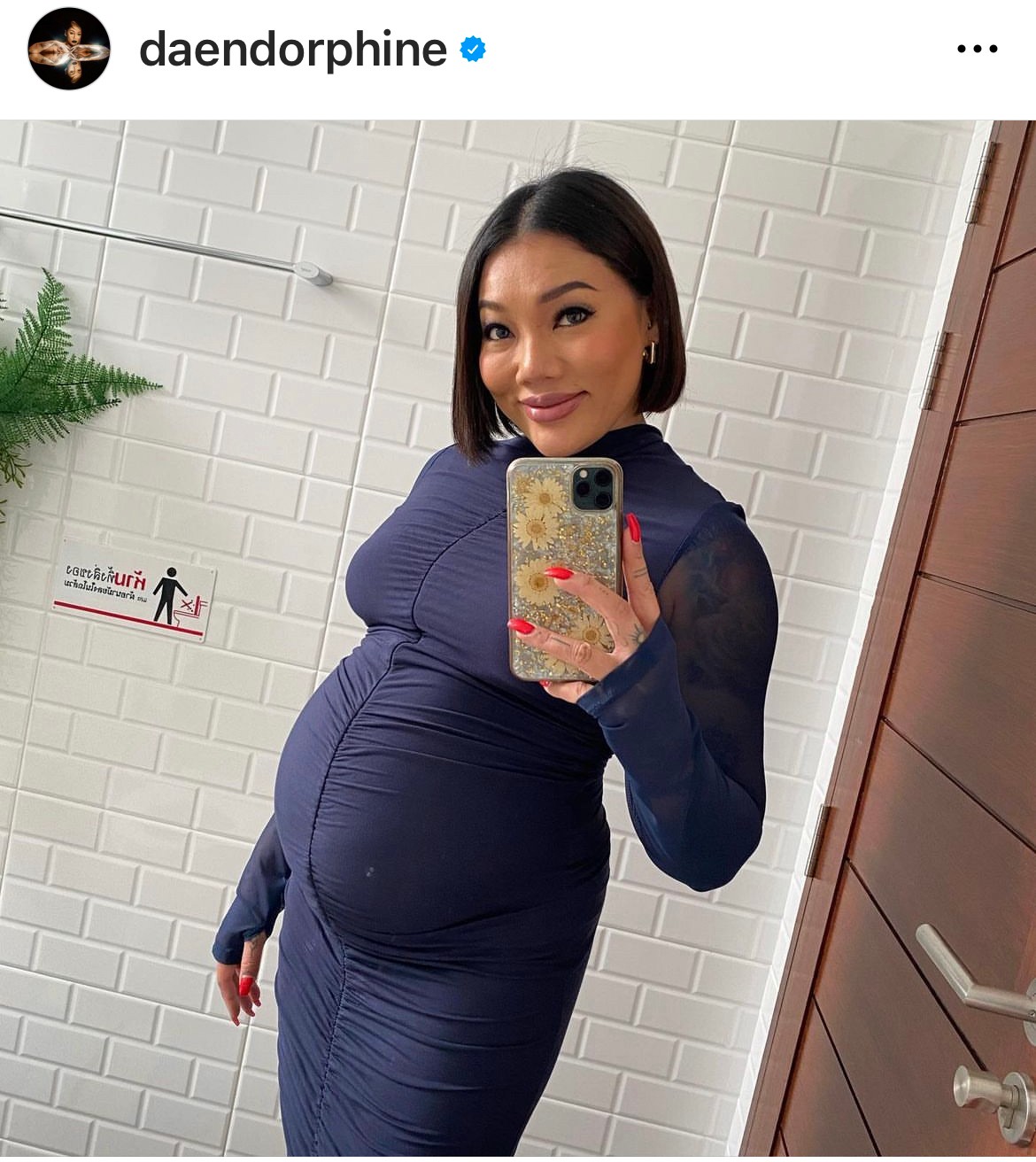 ดา เอ็นโดรฟิน ชวนทายเพศลูก คนบันเทิงและแฟนๆ แห่คอมเมนต์รัวๆ