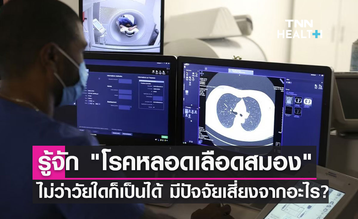 รู้จัก "โรคหลอดเลือดสมองตีบ แตก ตัน" มีปัจจัยเสี่ยงมาจากอะไร?