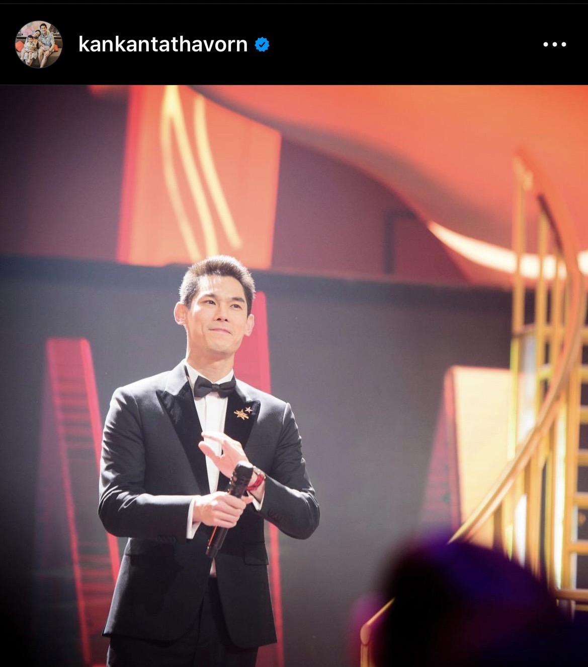 ไม่ต้องตกใจ กันต์ กันตถาวร ภาพรอยช้ำที่แขน ยันไม่ได้ทะเลาะกับเมีย