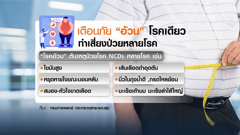 ภัยเงียบ ภาวะอ้วน โรคเดียวเสี่ยงป่วยอีกหลายโรค ภัยเงียบ ภาวะอ้วน โรคเดียวเสี่ยงป่วยอีกหลายโรค