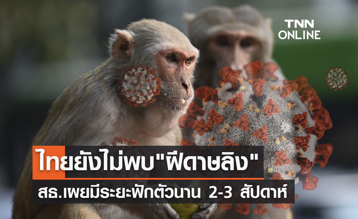 ยกระดับเฝ้าระวัง! กรมควบคุมโรคยืนยันไทยยังไม่พบโรค "ฝีดาษลิง"