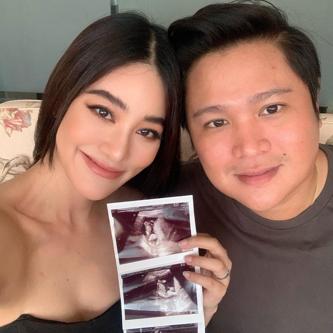  พิตต้า คุณแม่มือใหม่!! แจ้งข่าวดี ตั้งครรภ์ 16 สัปดาห์แล้ว