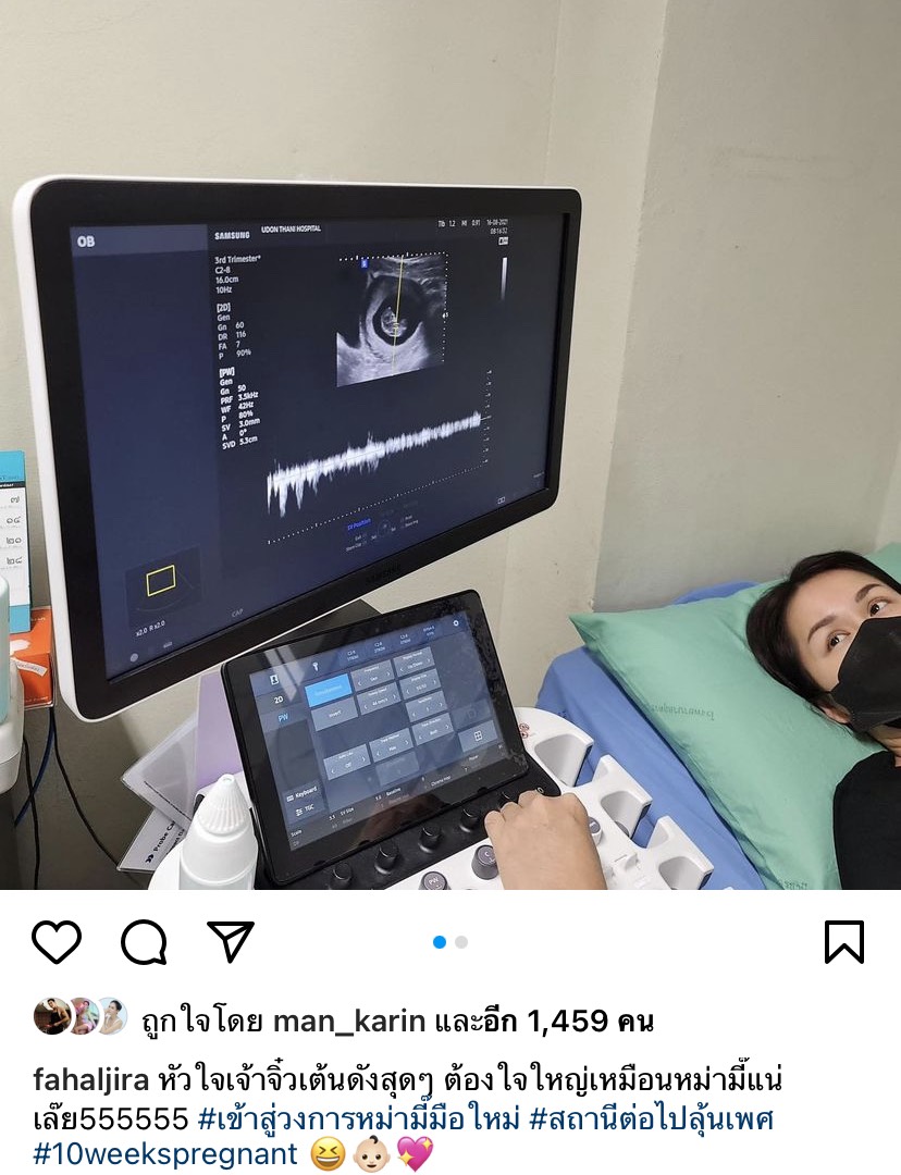 เตรียมเป็นคุณแม่มือใหม่ นักแสดงสาว ฟ้าใส อรจิรา ภรรยาผู้ว่าฯ อุดรธานี ประกาศท้องแล้วจ้า เตรียมเป็นคุณแม่มือใหม่ นักแสดงสาว ฟ้าใส อรจิรา ภรรยาผู้ว่าฯ อุดรธานี ประกาศท้องแล้วจ้า