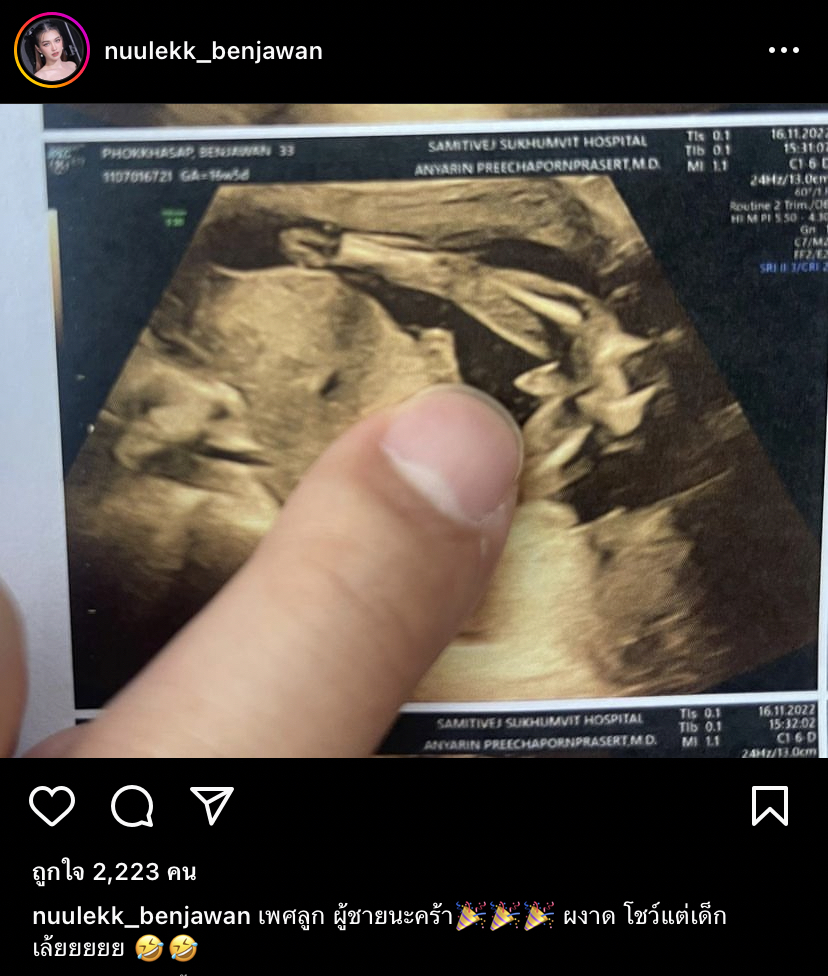 ผงาดโชว์ตั้งแต่เด็ก! หนูเล็ก บลูเบอร์รี่ เฉลยเพศลูกแล้ว