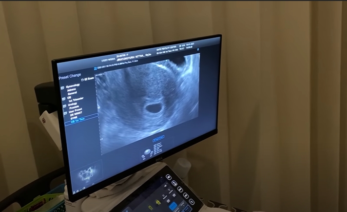แม่ มิว ษฐา เผยโมเมนต์สุดตื้นต้น หลังลูกสาวบอกข่าวดีเตรียมเป็นคุณยาย 