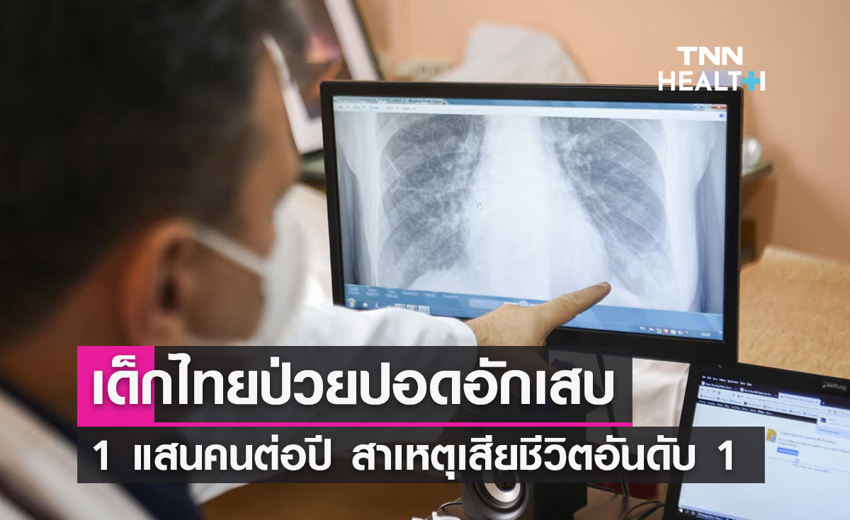พบเด็กไทยป่วยปอดอักเสบกว่า 1 แสนคนต่อปี  เสียชีวิตเป็นอันดับ 1 