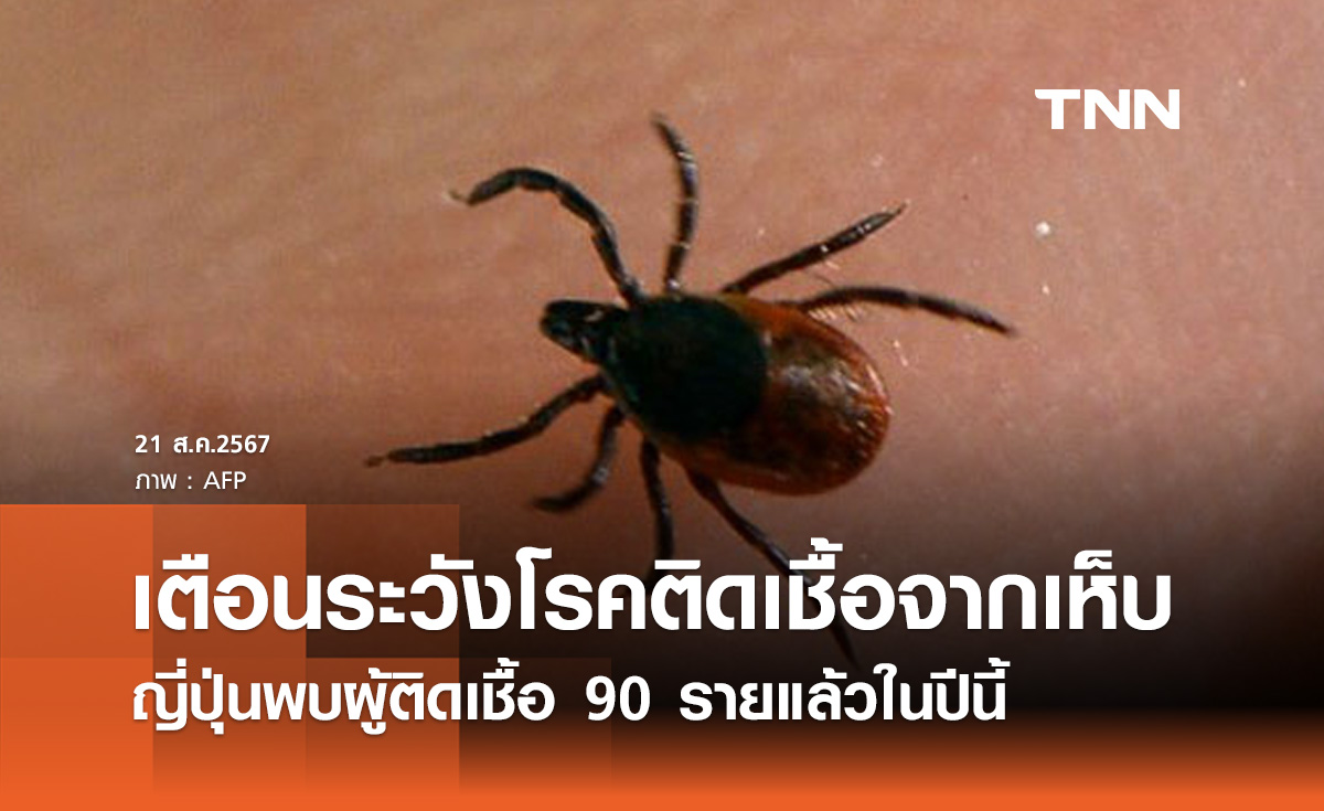 เตือน! เฝ้าระวังโรคติดเชื้อจาก "เห็บ" ญี่ปุ่นพบผู้ติดเชื้อแล้ว 90 รายแล้ว