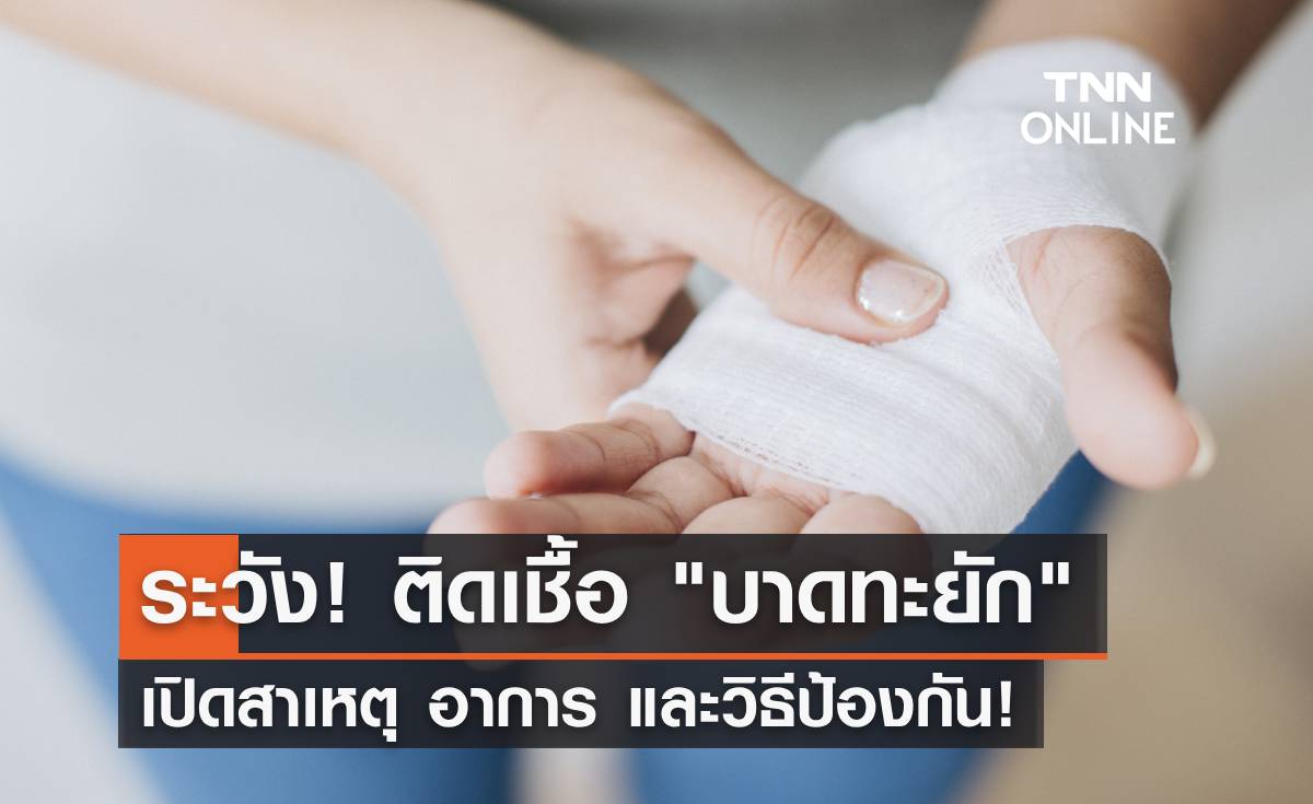 "บาดทะยัก" โรคติดเชื้อที่ต้องระวัง เปิดสาเหตุ อาการ และวิธีป้องกัน เช็คเลย!