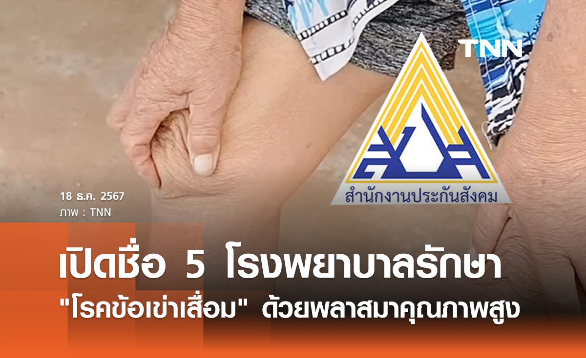ประกันสังคม เปิดชื่อ 5 โรงพยาบาลรักษา "โรคข้อเข่าเสื่อม" ด้วยพลาสมาคุณภาพสูง