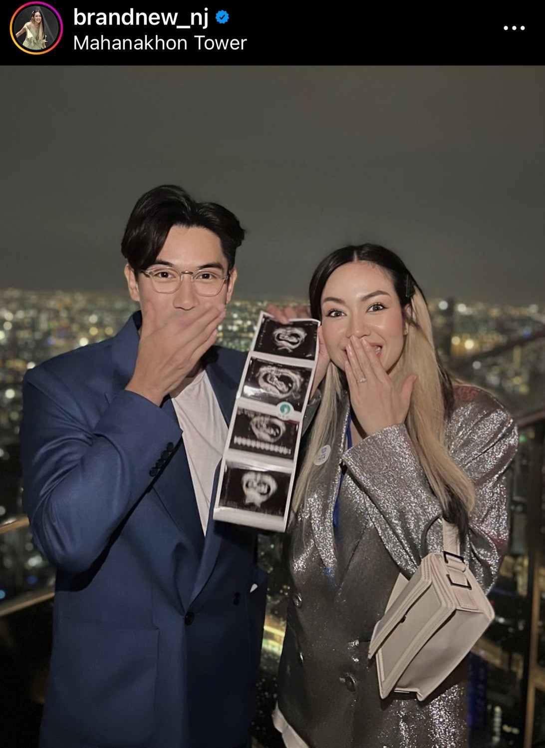 นิว-เป๊ก ประกาศข่าวดี เบบี๋มาแล้ว!!