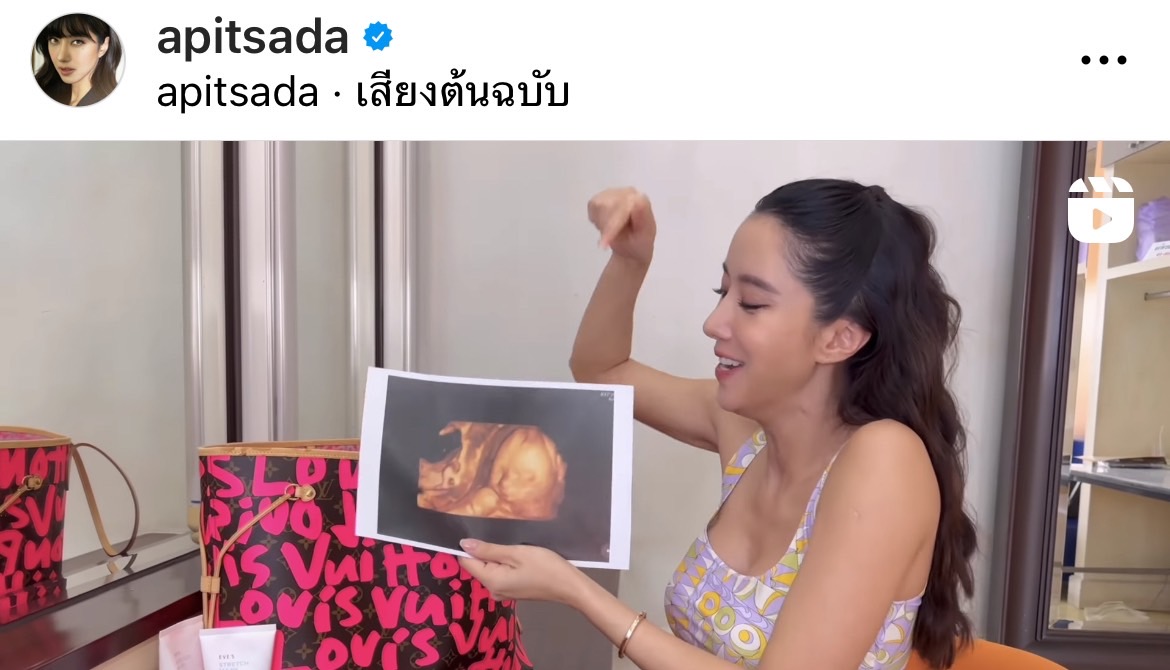 คุณแม่สายแซ่บ!! ไอซ์ อภิษฎา อวดครรภ์ 8 เดือน 
