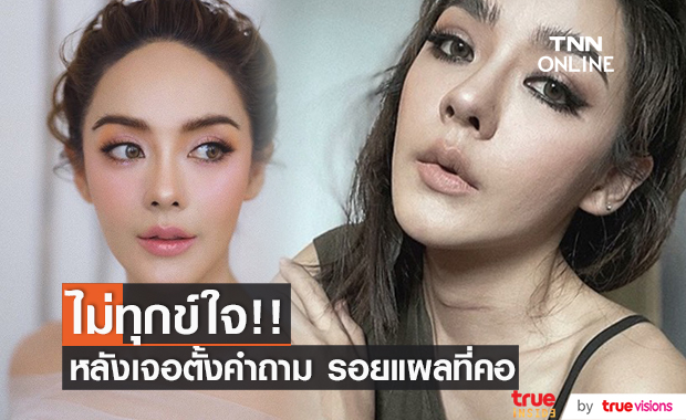 ปุยฝ้าย เปิดรอยแผลที่คอ เผยไม่ขาดความมั่นใจ และ ไม่เป็นทุกข์!!
