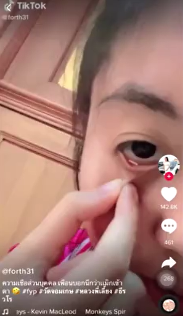 แพทย์ เตือน ฝังตะกรุดทอง สาริกาตาหวาน เสี่ยงตาบอด