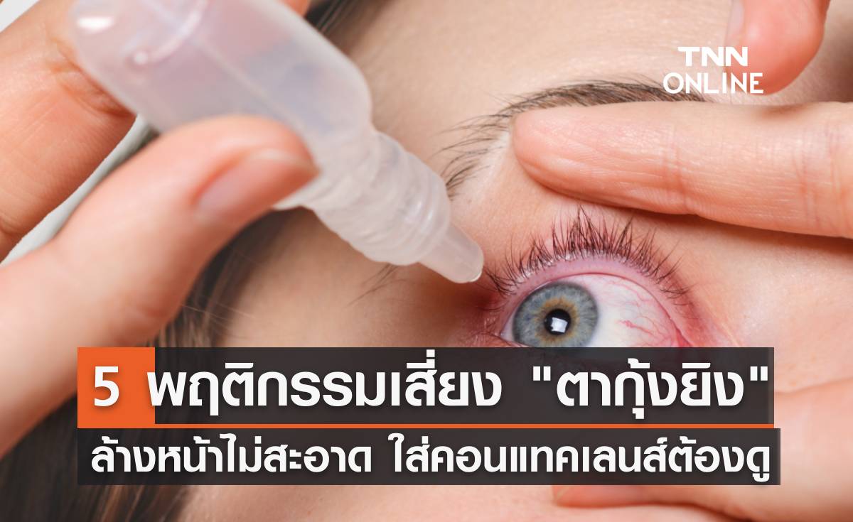 5 พฤติกรรมเสี่ยง "ตากุ้งยิง" ล้างหน้าไม่สะอาด ใส่คอนแทคเลนส์บ่อยๆ ต้องดู!