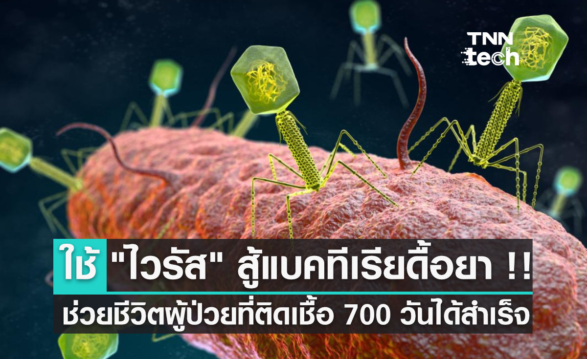 นักวิจัยใช้ ไวรัส สู้แบคทีเรียดื้อยา จนช่วยชีวิตผู้ป่วยที่ติดเชื้อนาน 700 วันได้สำเร็จ