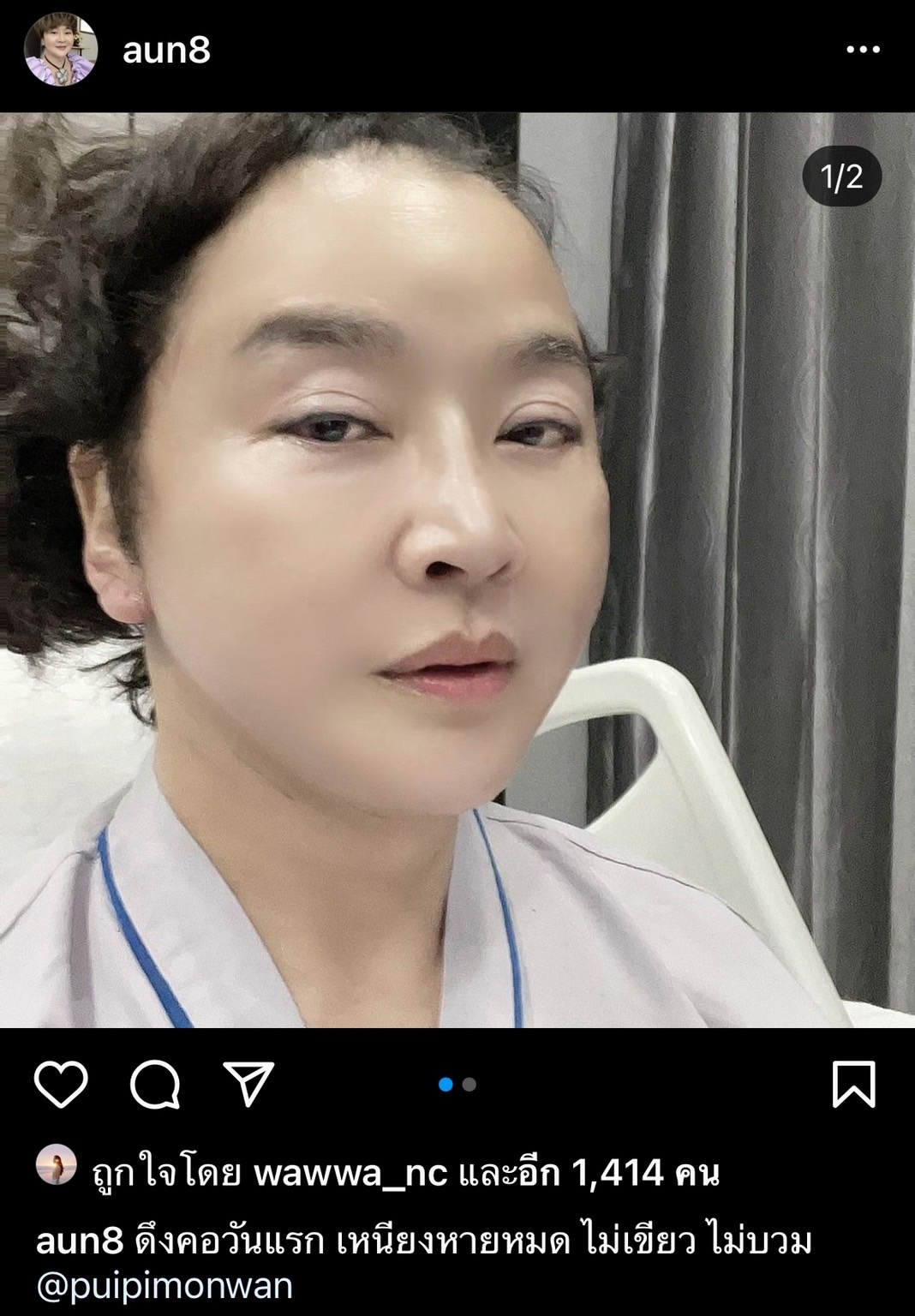 จัดชุดใหญ่!! อ้วน รีเทิร์น ผ่าตัดเหนียง เสริมความงาม จัดชุดใหญ่!! อ้วน รีเทิร์น ผ่าตัดเหนียง เสริมความงาม