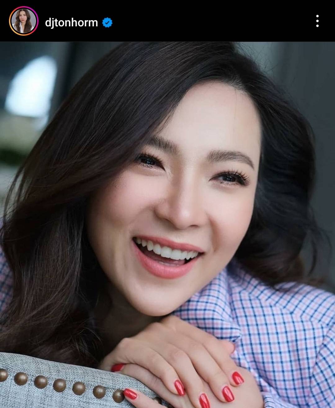 ต้นหอม เผชิญโรคผิวหนังนาน 10 ปี ที่พบได้เพียง 1 ใน 3 แสนคน ต้นหอม เผชิญโรคผิวหนังนาน 10 ปี ที่พบได้เพียง 1 ใน 3 แสนคน