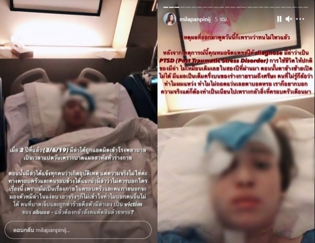 ชาวเน็ตถล่มดราม่า พรีน โพสต์อยากให้ฟังความครอบครัว มิล่า ด้าน หวาย เผยสภาพจิตใจเพื่อนตอนนี้ ชาวเน็ตถล่มดราม่า พรีน โพสต์อยากให้ฟังความครอบครัว มิล่า ด้าน หวาย เผยสภาพจิตใจเพื่อนตอนนี้