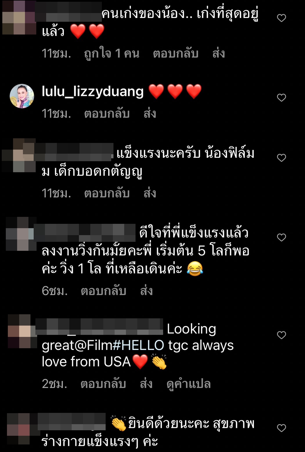 ฟิล์ม รัฐภูมิ อัปเดตผลตรวจร่างกาย หลังผ่าตัดลิ้นหัวใจรั่วครบ 3 เดือน 