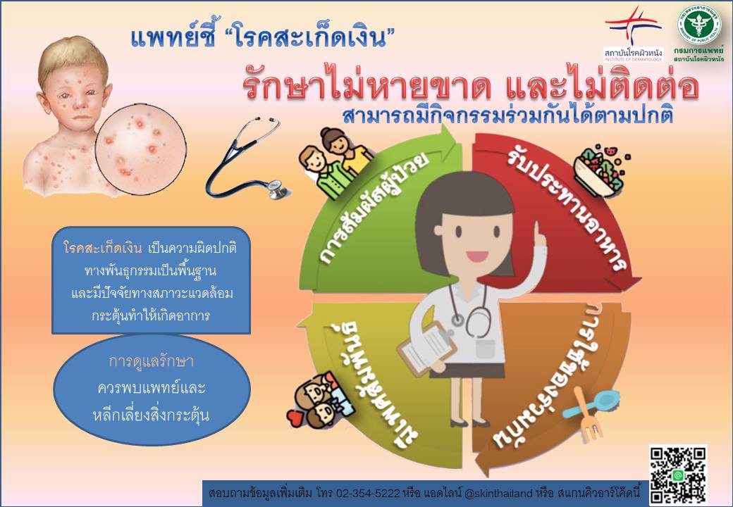 วันนี้วันอะไร วันสะเก็ดเงินโลก ตรงกับวันที่ 29 ตุลาคม วันนี้วันอะไร วันสะเก็ดเงินโลก ตรงกับวันที่ 29 ตุลาคม