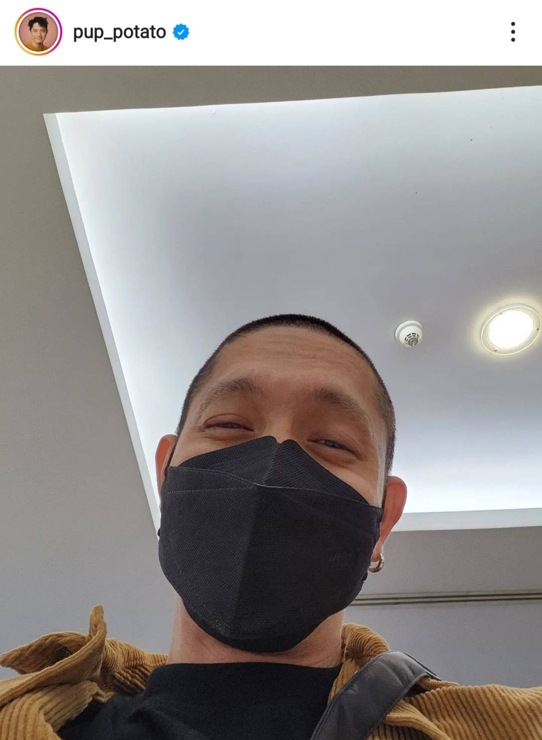 ปั๊บ โปเตโต้ แชร์ประสบการณ์ ก้างติดคอ ต้องล้วงคอลึกมาก