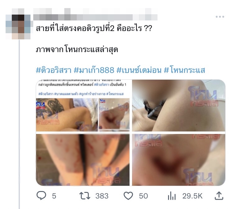 ชาวเน็ตสงสัย! เครื่องประดับบนคอ ดิว อรสรา คล้ายกับเครื่องฝึกสุนัข?