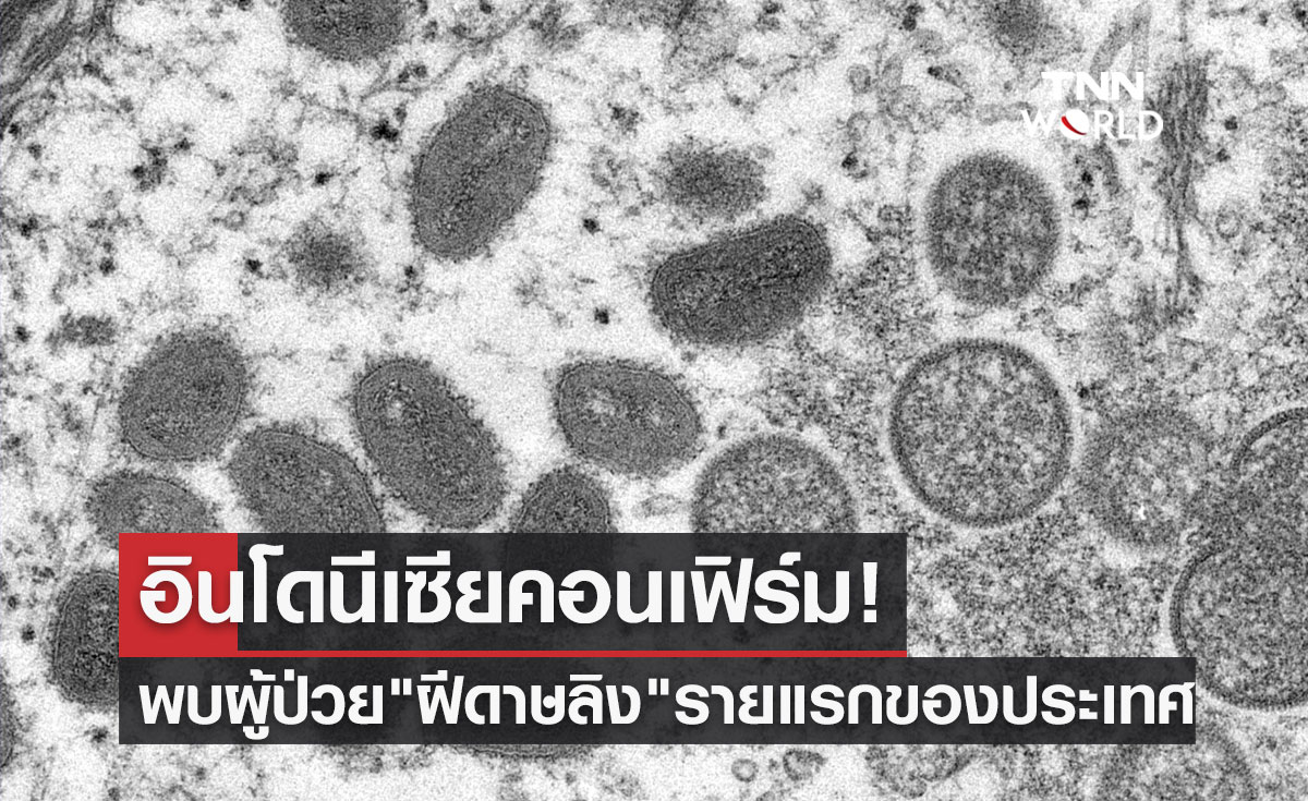 อินโดนีเซีย ยืนยันพบผู้ป่วย "ฝีดาษลิง" รายแรกของประเทศ