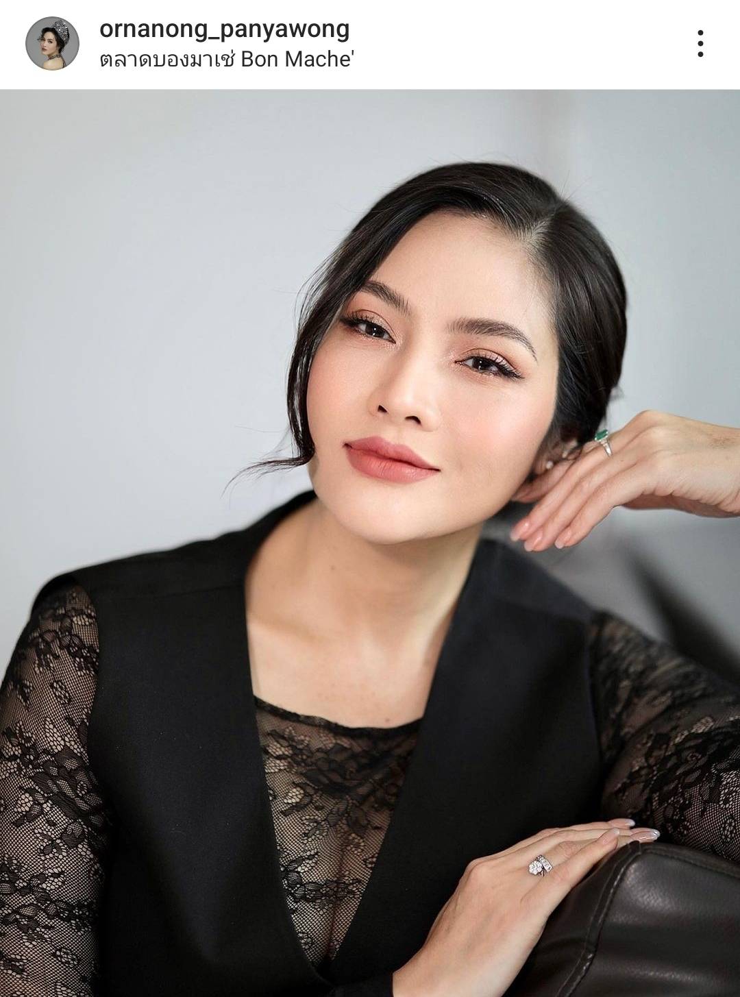 อรอนงค์ ตรวจพบต่อมไทมัสโต เตรียมผ่าตัด ตุลาคมนี้ อรอนงค์ ตรวจพบต่อมไทมัสโต เตรียมผ่าตัด ตุลาคมนี้