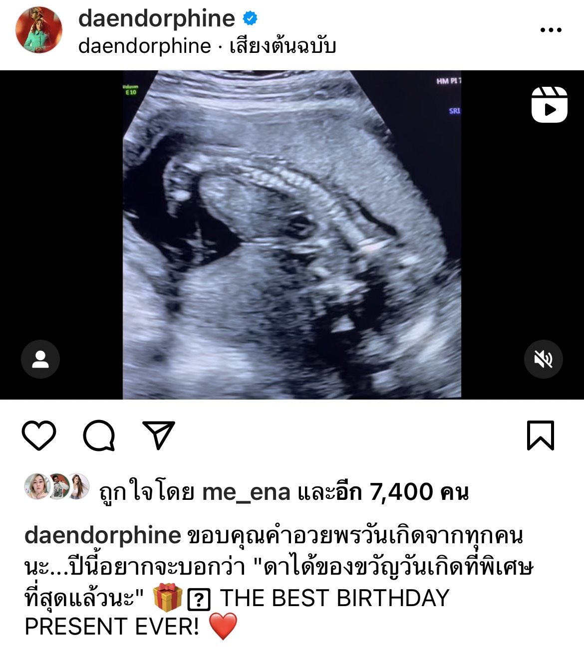  เบบี๋มาแล้ว! ดา เอ็นโดรฟิน ได้ของขวัญวันเกิดที่พิเศษที่สุด