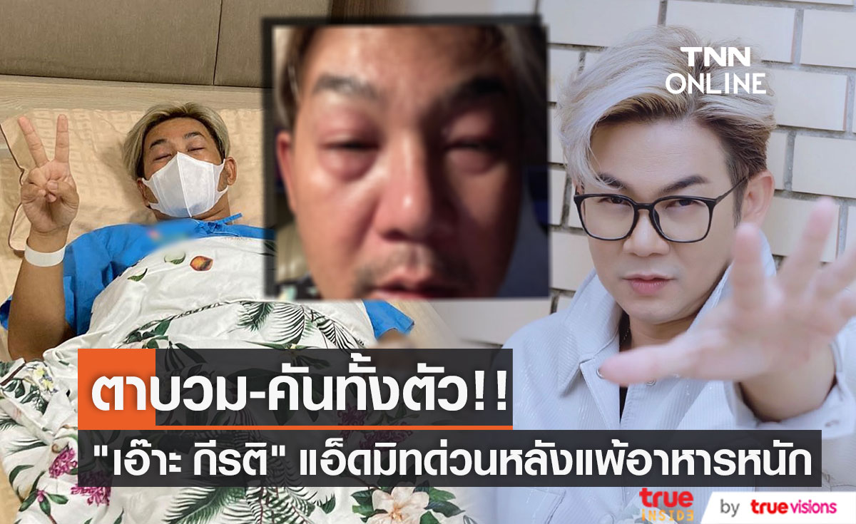 "เอ๊าะ กีรติ" แอ็ดมิทด่วน แพ้อาหารหนัก ตาบวม คันทั้งตัว!!
