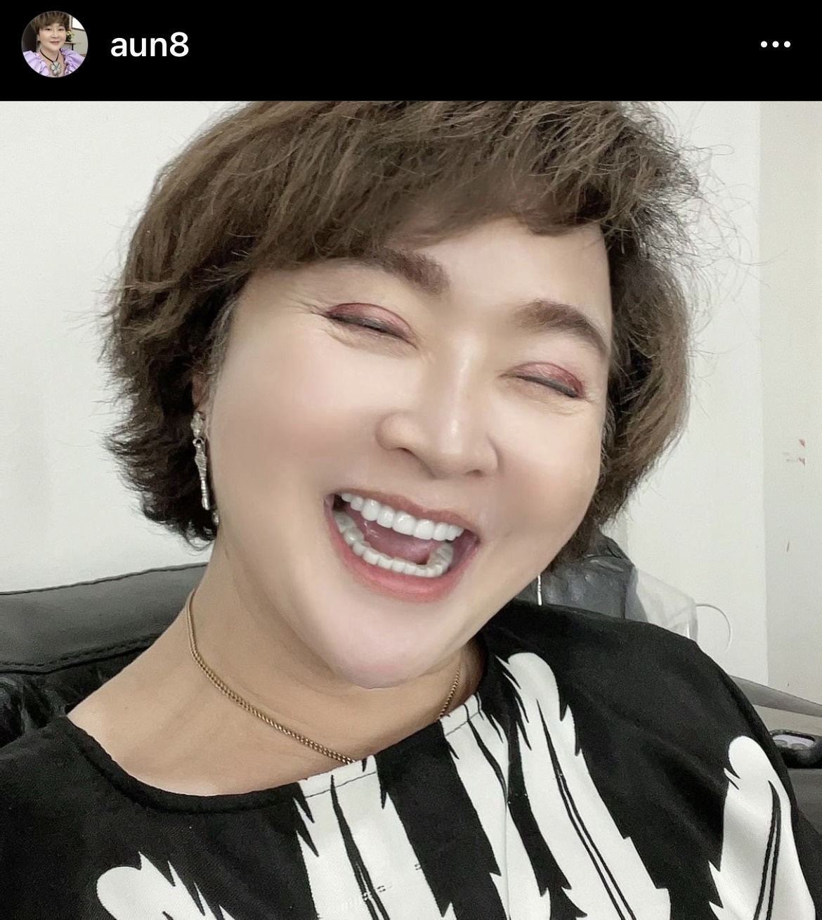 จัดชุดใหญ่!! อ้วน รีเทิร์น ผ่าตัดเหนียง เสริมความงาม จัดชุดใหญ่!! อ้วน รีเทิร์น ผ่าตัดเหนียง เสริมความงาม