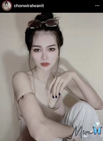 เอ๋ มิรา อัพความสวย ศัลยกรรมจมูก ตา และคาง 