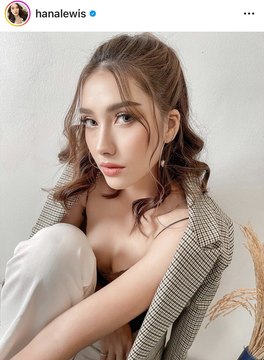 ฮาน่า ลีวิส ทำแฟนคลับเป็นห่วง หลังมีอาการกระจกตาถลอก เยื้อตาอักเสบ