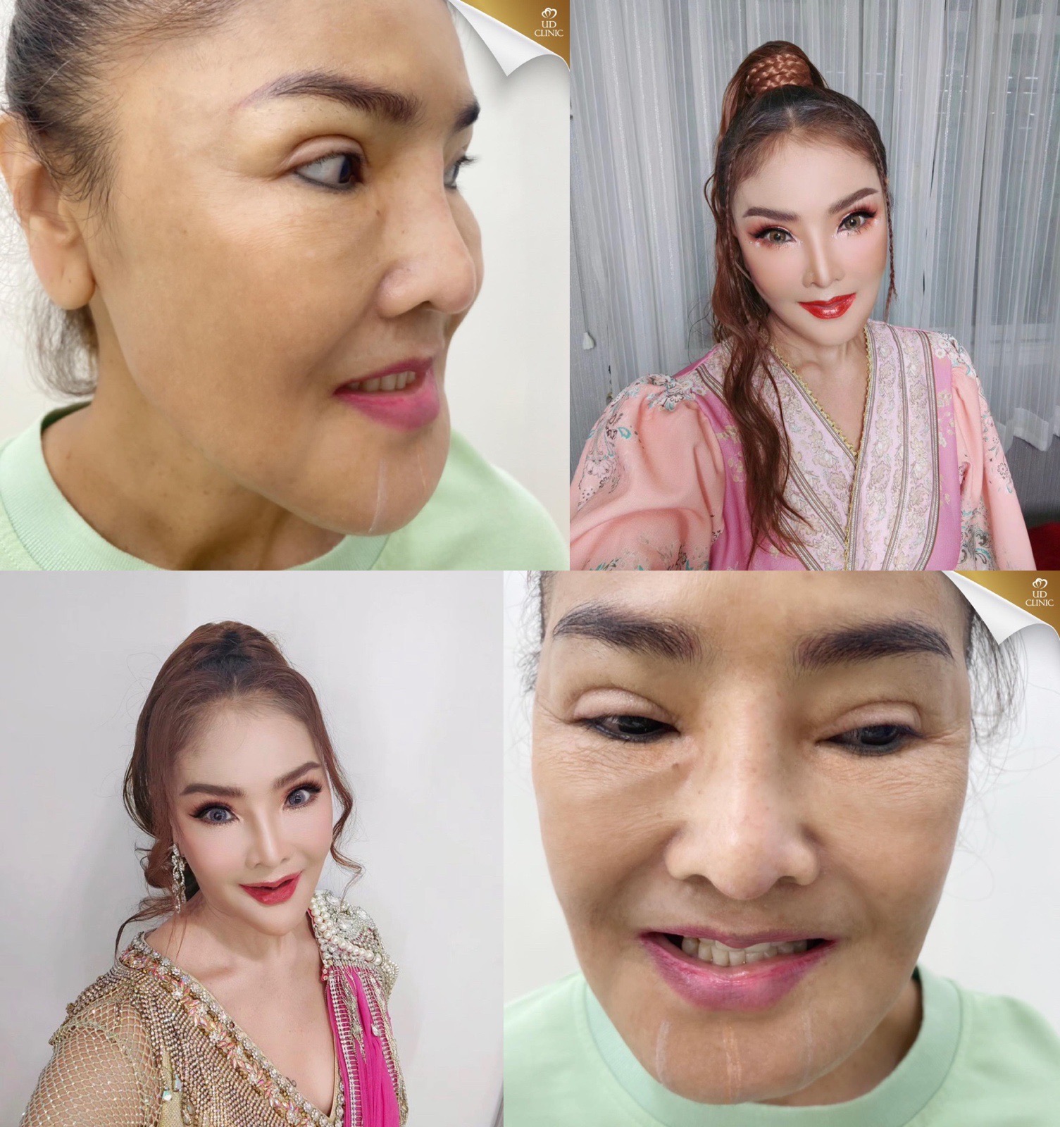 ดาว มุยรี เดือด!! ซัดกลับชาวเน็ตแซะ หน้าเหมือนตุ๊กตายาง ดาว มุยรี เดือด!! ซัดกลับชาวเน็ตแซะ หน้าเหมือนตุ๊กตายาง