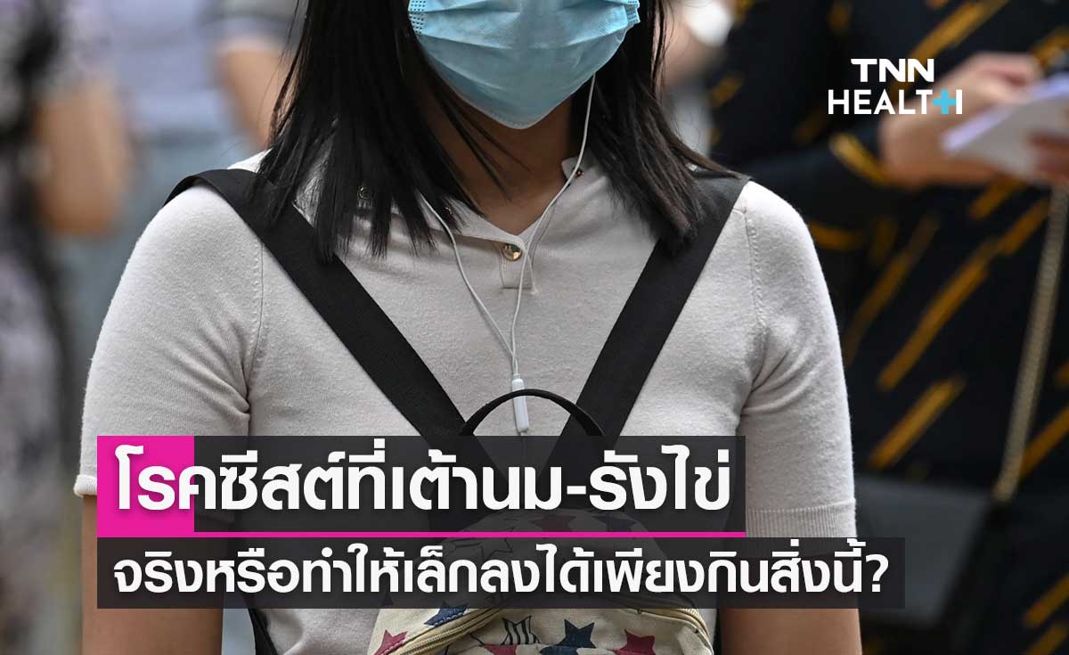 โรคซีสต์ที่เต้านม-รังไข่ ทำให้เล็กลงได้เพียงกินสิ่งนี้? จริงหรือ