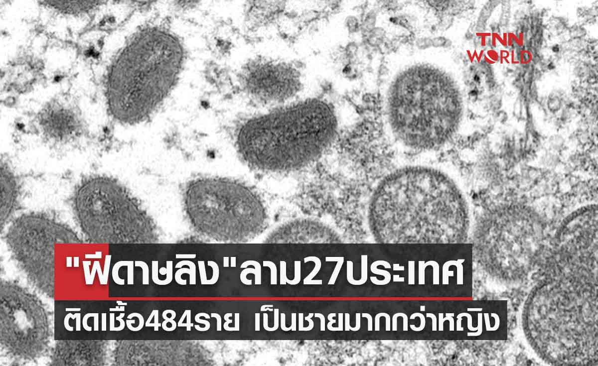 "ฝีดาษลิง" ลาม27ประเทศทั่วโลก ติดเชื้อ484ราย เป็นชายมากกว่าหญิง