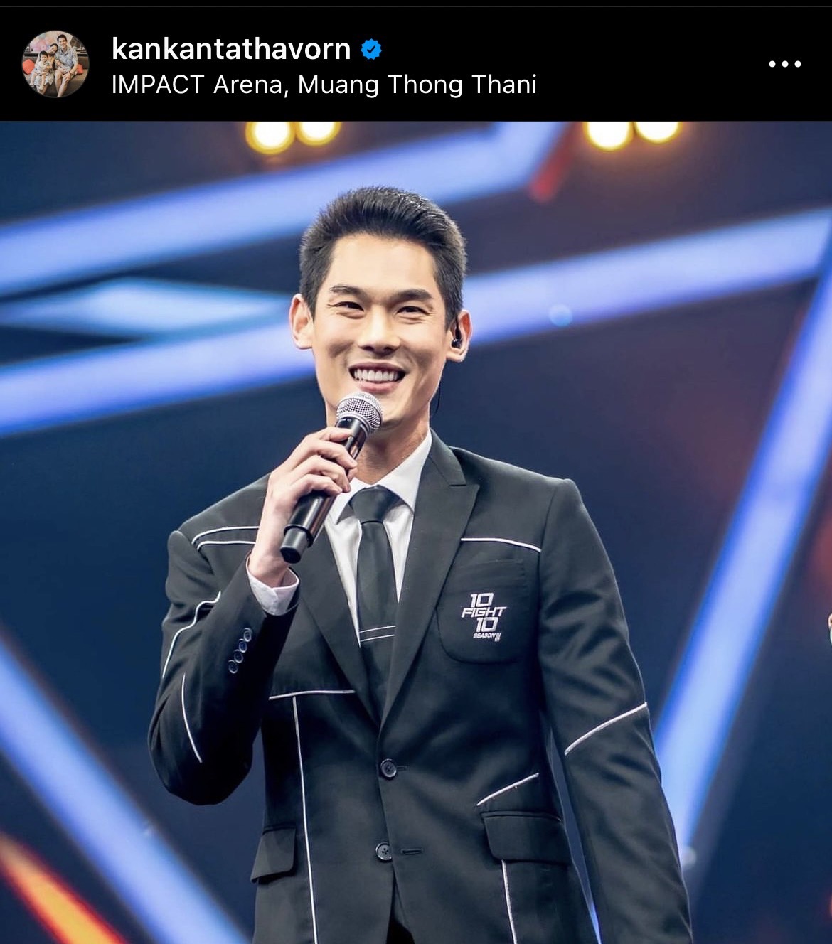 ไม่ต้องตกใจ กันต์ กันตถาวร ภาพรอยช้ำที่แขน ยันไม่ได้ทะเลาะกับเมีย