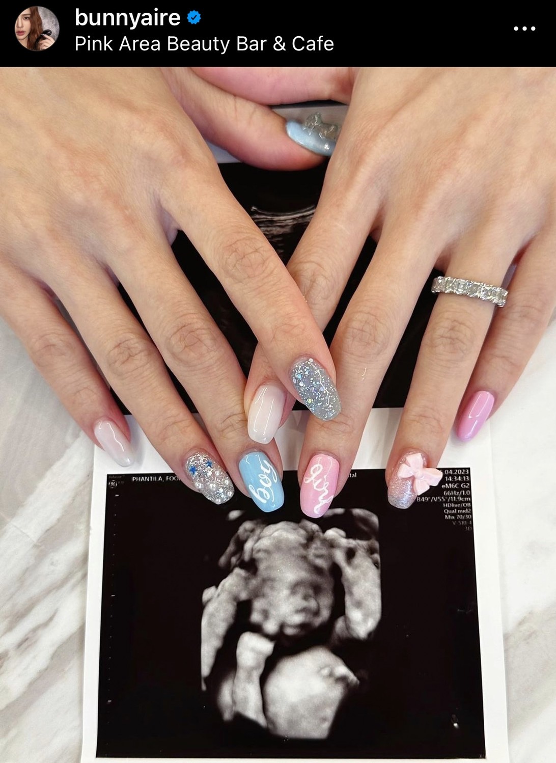 แอร์ ภัณฑิลา ชวนทายเพศลูกคนแรก เผยความรู้สึกหลังขึ้นแท่นเป็นคุณแม่ป้ายแดง 