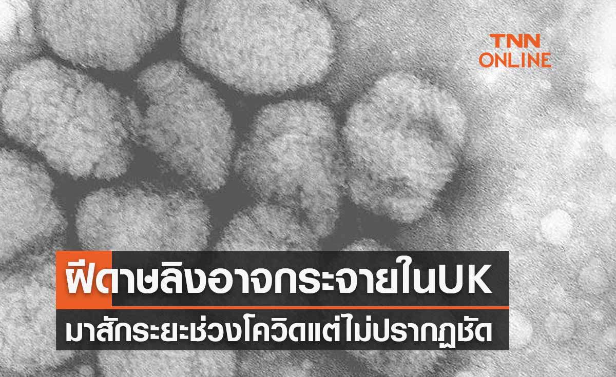 ฝีดาษลิง ดร.อนันต์เผยอาจกระจายใน UK มาสักพัก แต่ไม่ปรากฏชัด