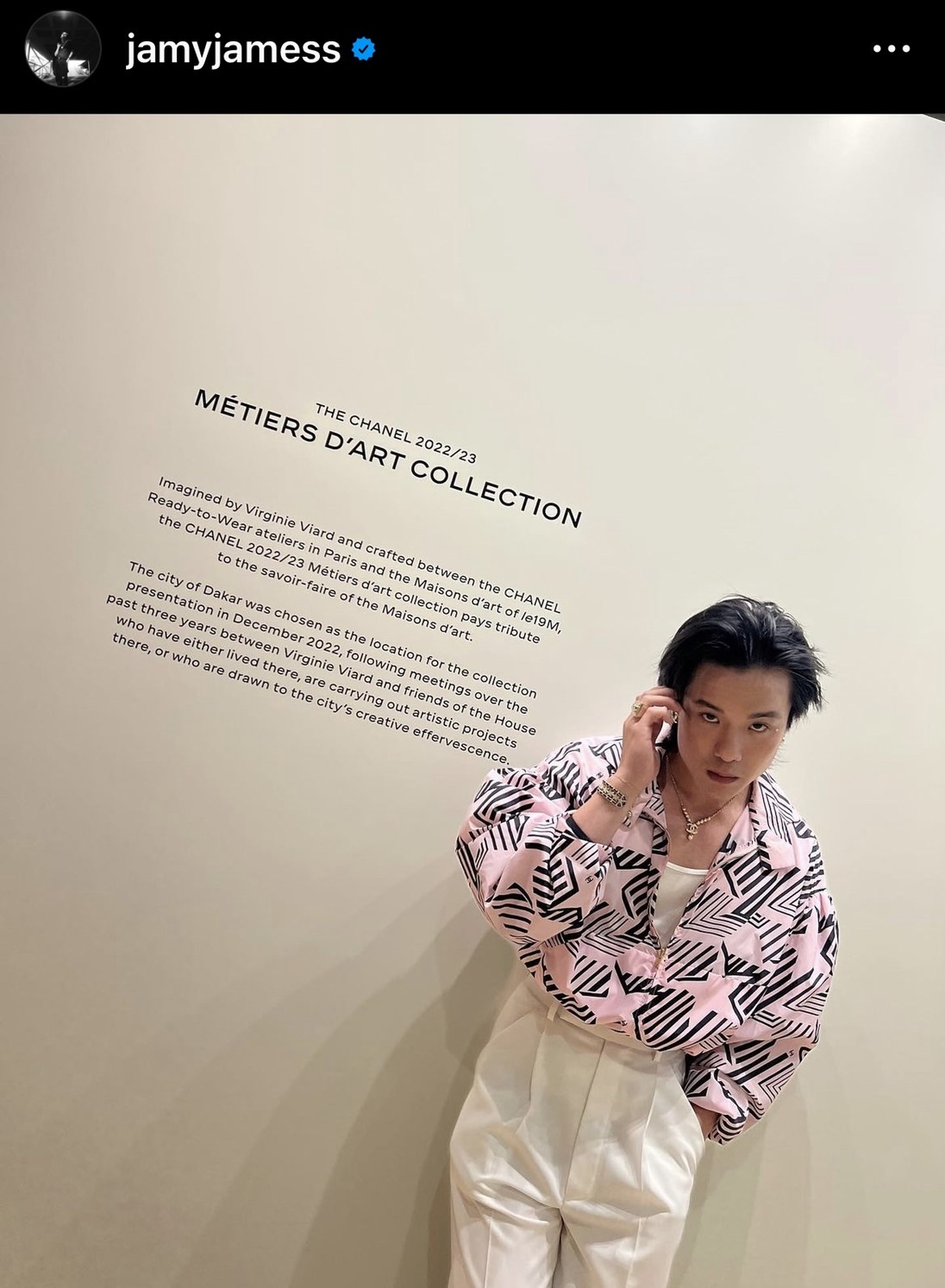 เจมส์ ธีรดนย์ ไม่กังวลหน้าเป็นแผลใหญ่ รับช่วงนี้น้ำหนักเพิ่ม
