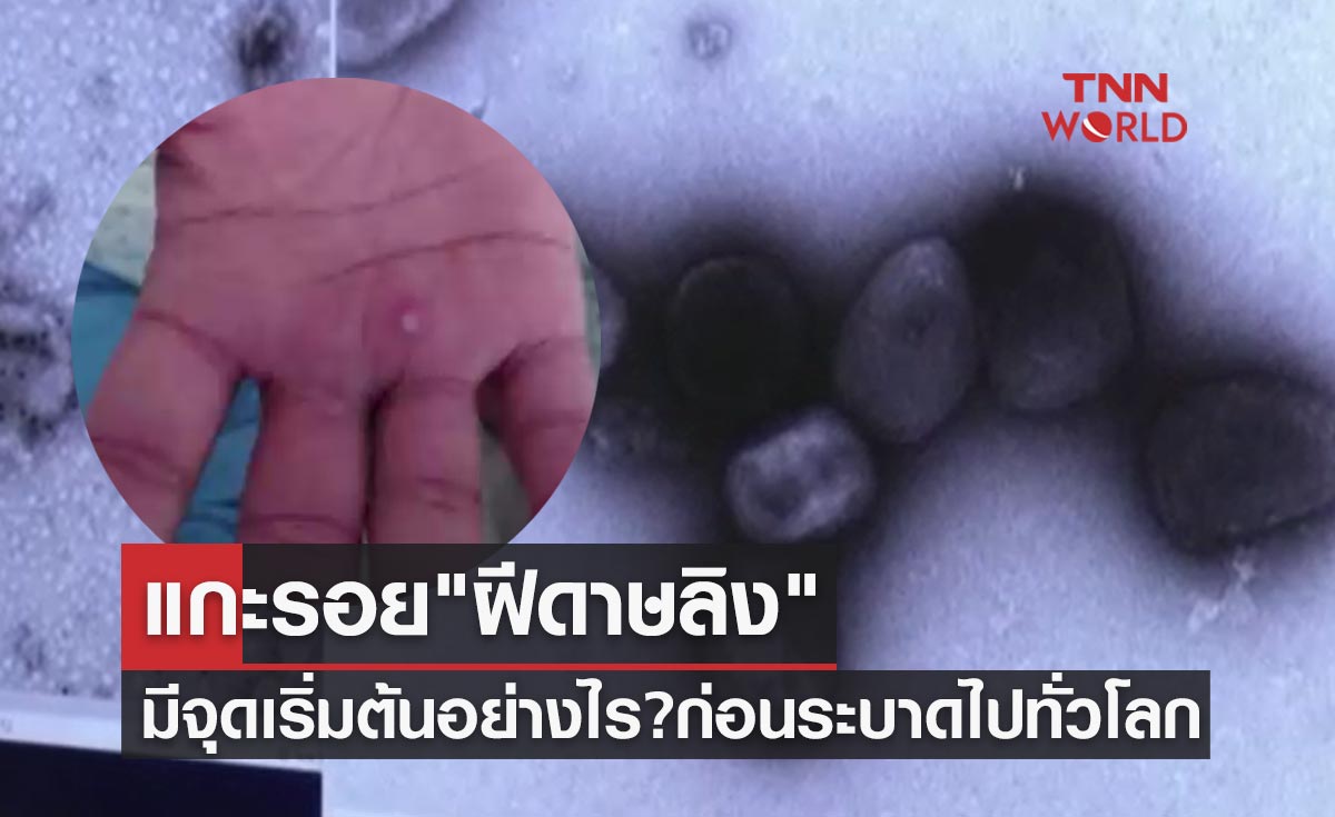 แกะรอย "ฝีดาษลิง" โรคนี้มีจุดเริ่มต้นอย่างไร? ก่อนแพร่ระบาดไปทั่วโลก