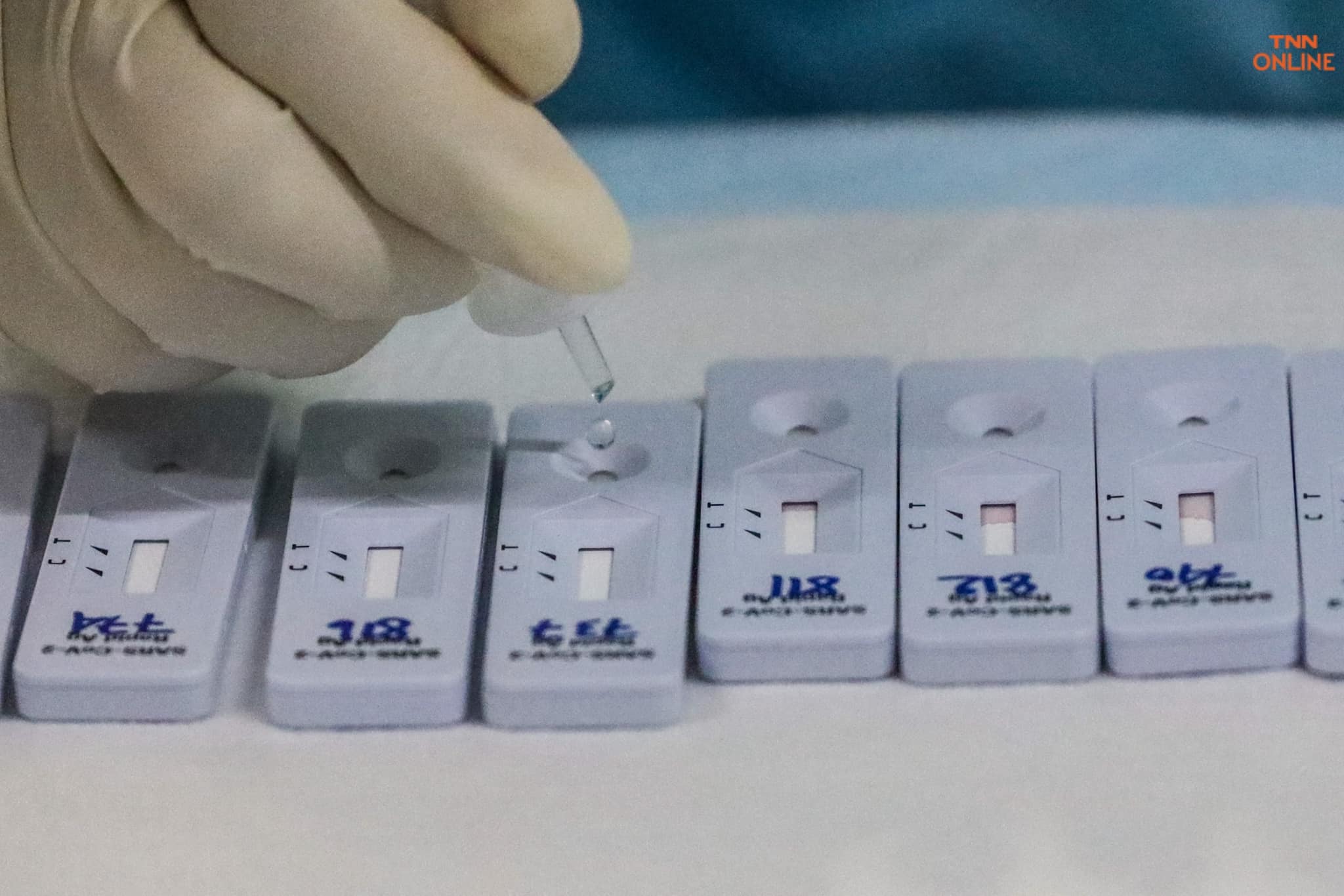 เริ่ม 8 ส.ค.นี้  รัฐสั่งซื้อ ชุดตรวจโควิด Antigen Test Kit 8.5 ล้านชุด แจกประชาชน 