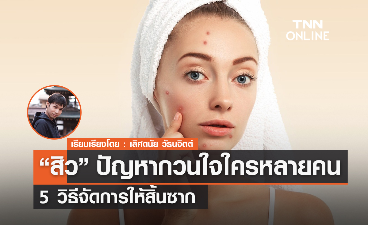 “สิว” ปัญหากวนใจใครหลายคน 5 วิธีจัดการให้สิ้นซาก