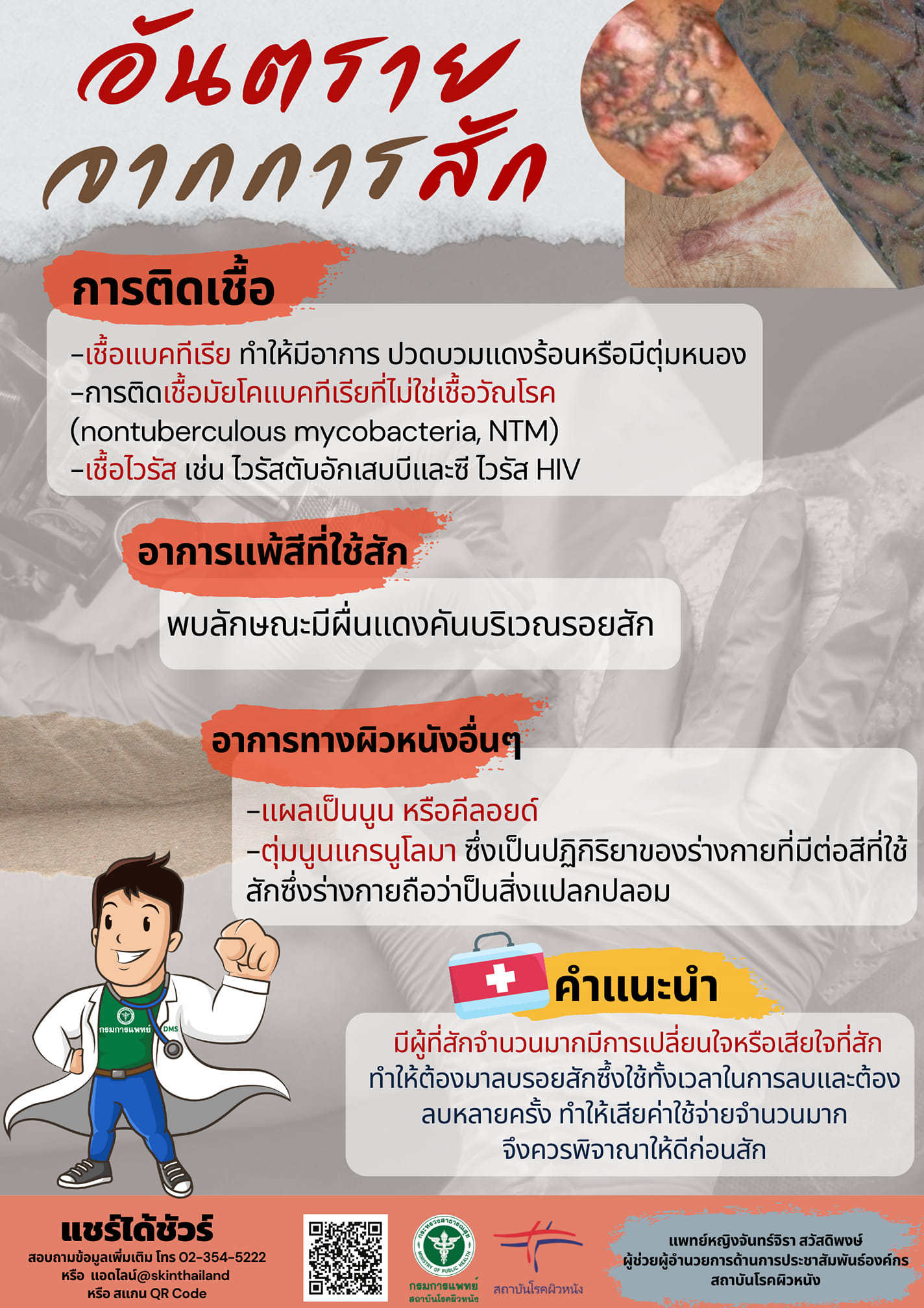 แพทย์ผิวหนังเตือนสักบริเวณใกล้ตาเสี่ยงอันตราย แพทย์ผิวหนังเตือนสักบริเวณใกล้ตาเสี่ยงอันตราย