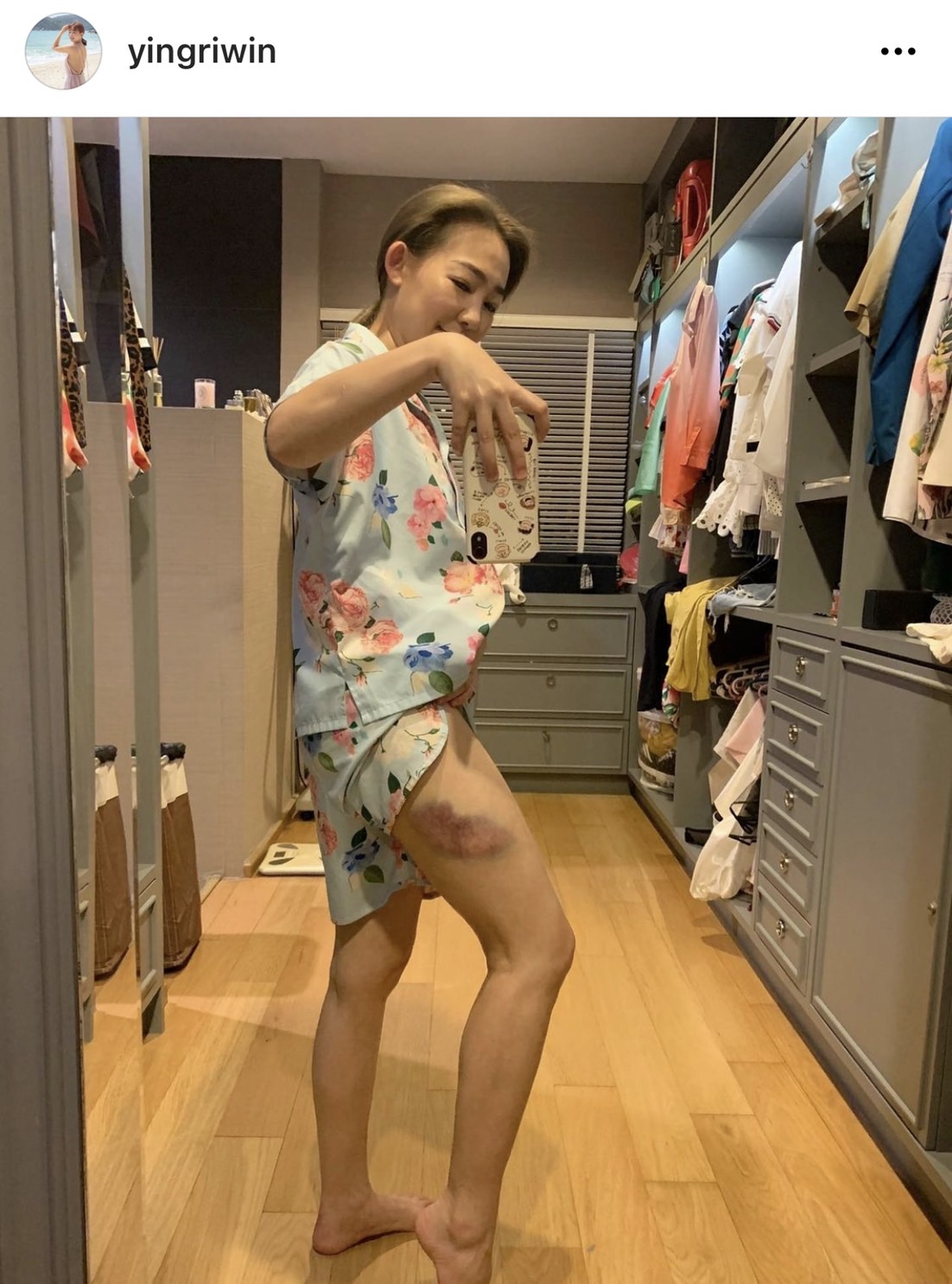 หญิง กัญญา เปิดใจ ถึงนาทีอุบัติเหตุ หกล้มหน้าบ้าน แจงชัด ต่อไปต้องระวังให้มากขึ้น