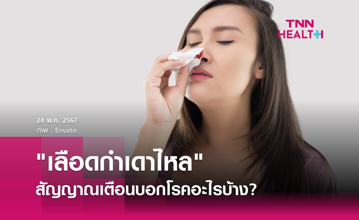 "เลือดกำเดาไหล" สัญญาณเตือนบอกโรคอะไรบ้าง?