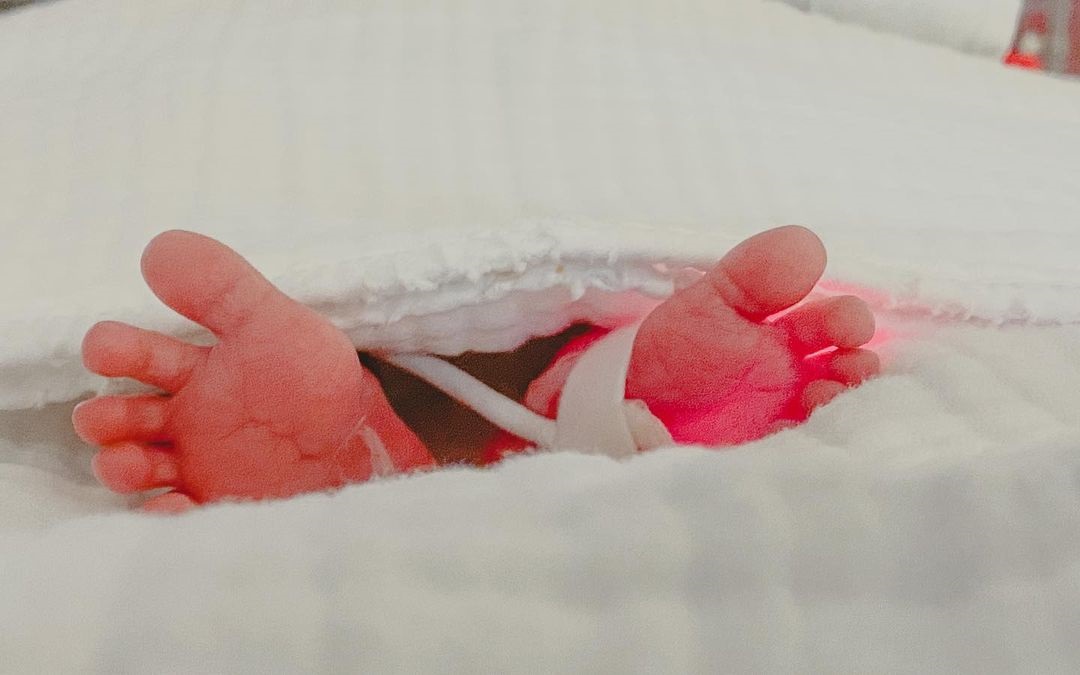 เป้ วงมายด์ เผยอาการลูกแฝด หลังคลอดก่อนกำหนดถึง 32 สัปดาห์